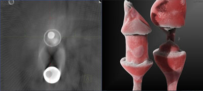 11 test bernard figure 3